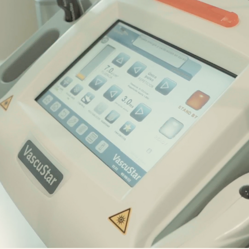 Asclepion Vascustar 3