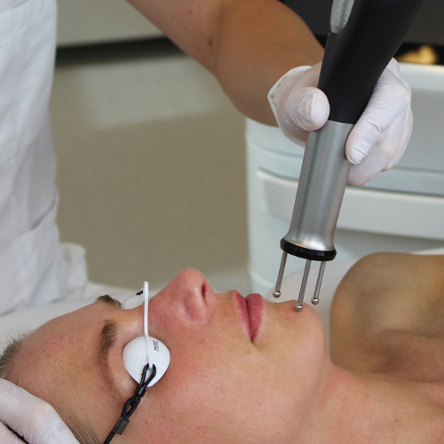 Dermablate 3
